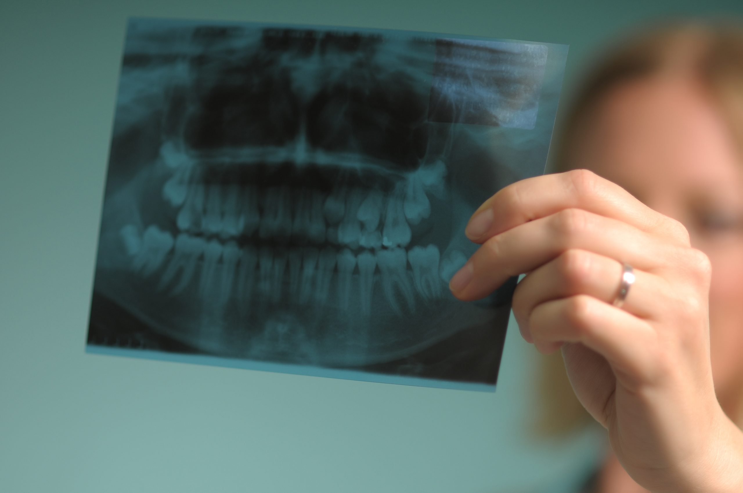 dental x-ray at Novak Dentistry at Riverwalk