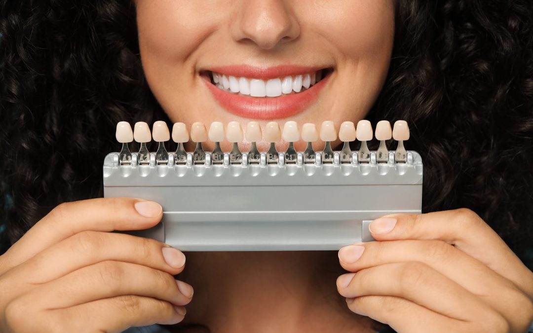 Learn about dental veneers with helpful info from Novak Dentistry at Riverwalk in Castle Rock CO